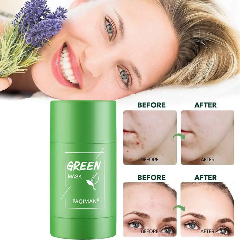 Green Mask - Mascara Facial Verde removedora de Cravos Espinhas e Acnes